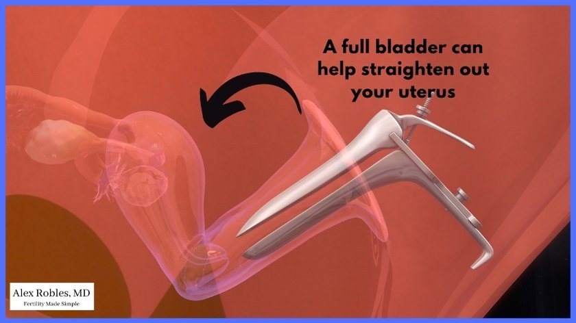 image of a speculum going into a 3d vagina to show the location of the uterus relative to the bladder for an embryo transfer