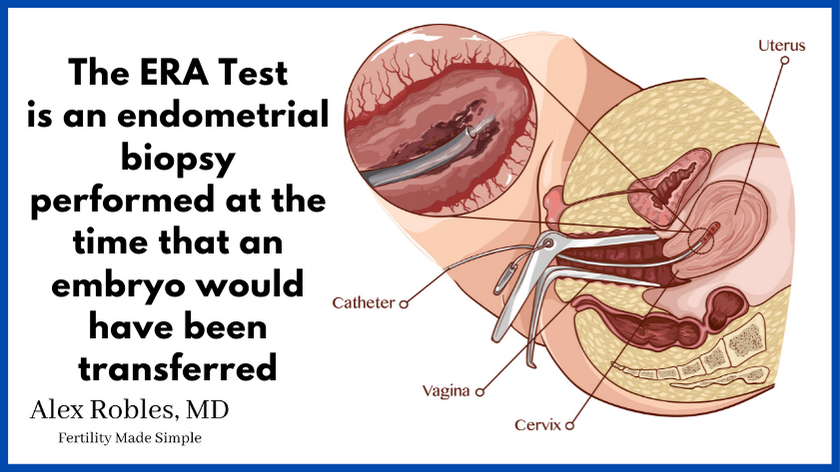 image of a speculum in a vagina passing a small biopsy pipette into the uterus to do a biopsy: image says "the ERA test is an endometrial biopsy performed at the time that an embryo would have been transferred"
