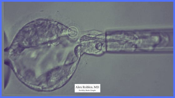 picture of an embryo biopsy - a small suction straw pulling cells from the outer later of the embryo