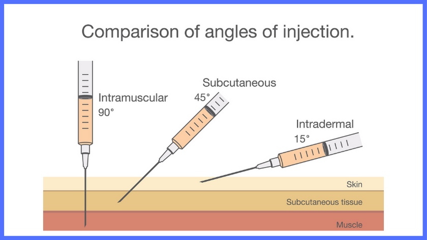 showing a needle going into the skin at 90 degrees (intramuscular) vs 45 degrees (subcutaneosu)