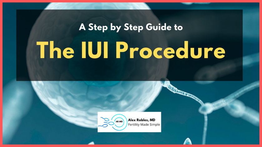 iui-procedure step by step cover image